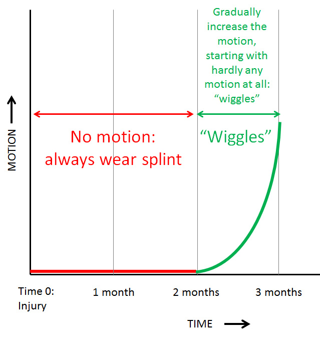 Mallet Wiggles Diagram