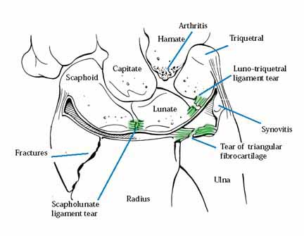 Wrist Anatomy