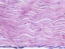Microscopic view of a normal tendon